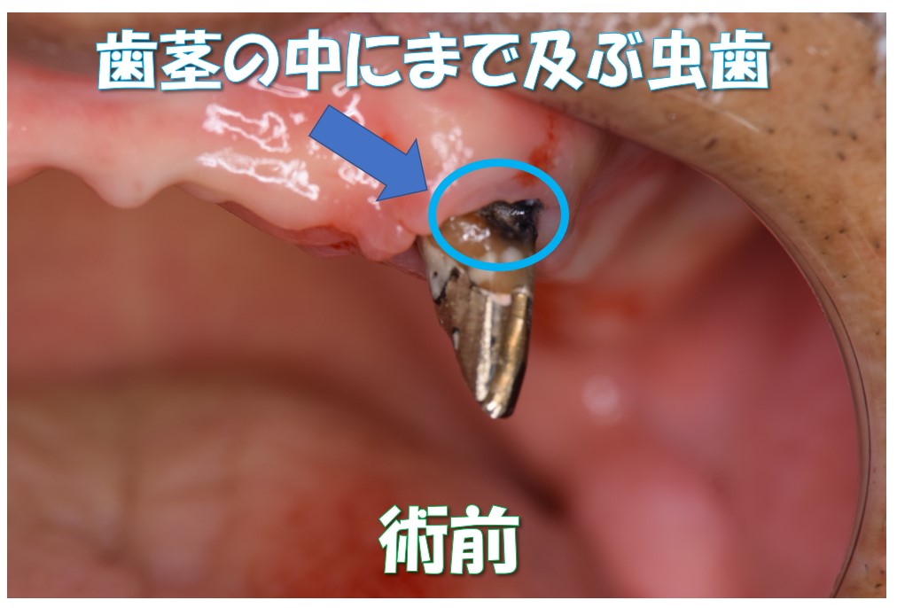 case1-1