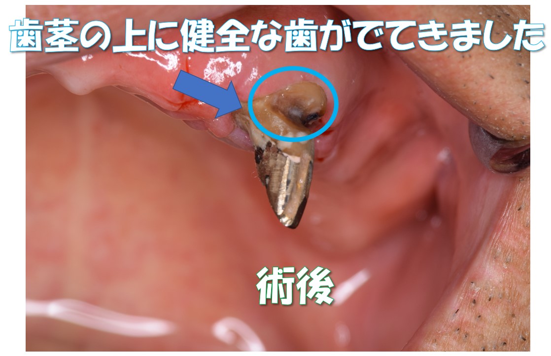 case1-2
