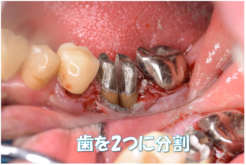 case2-01