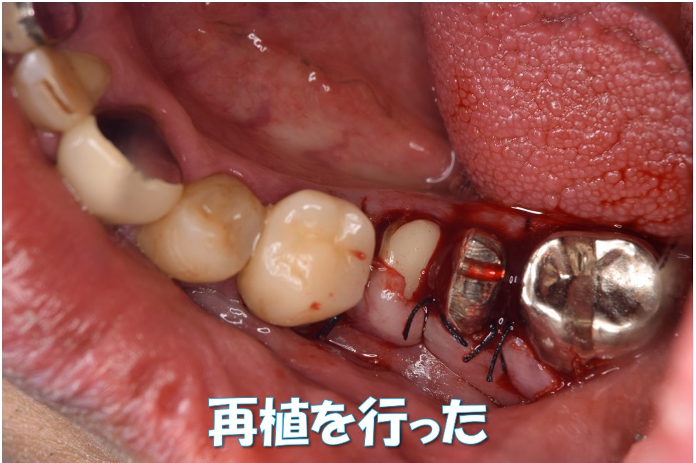case2-3