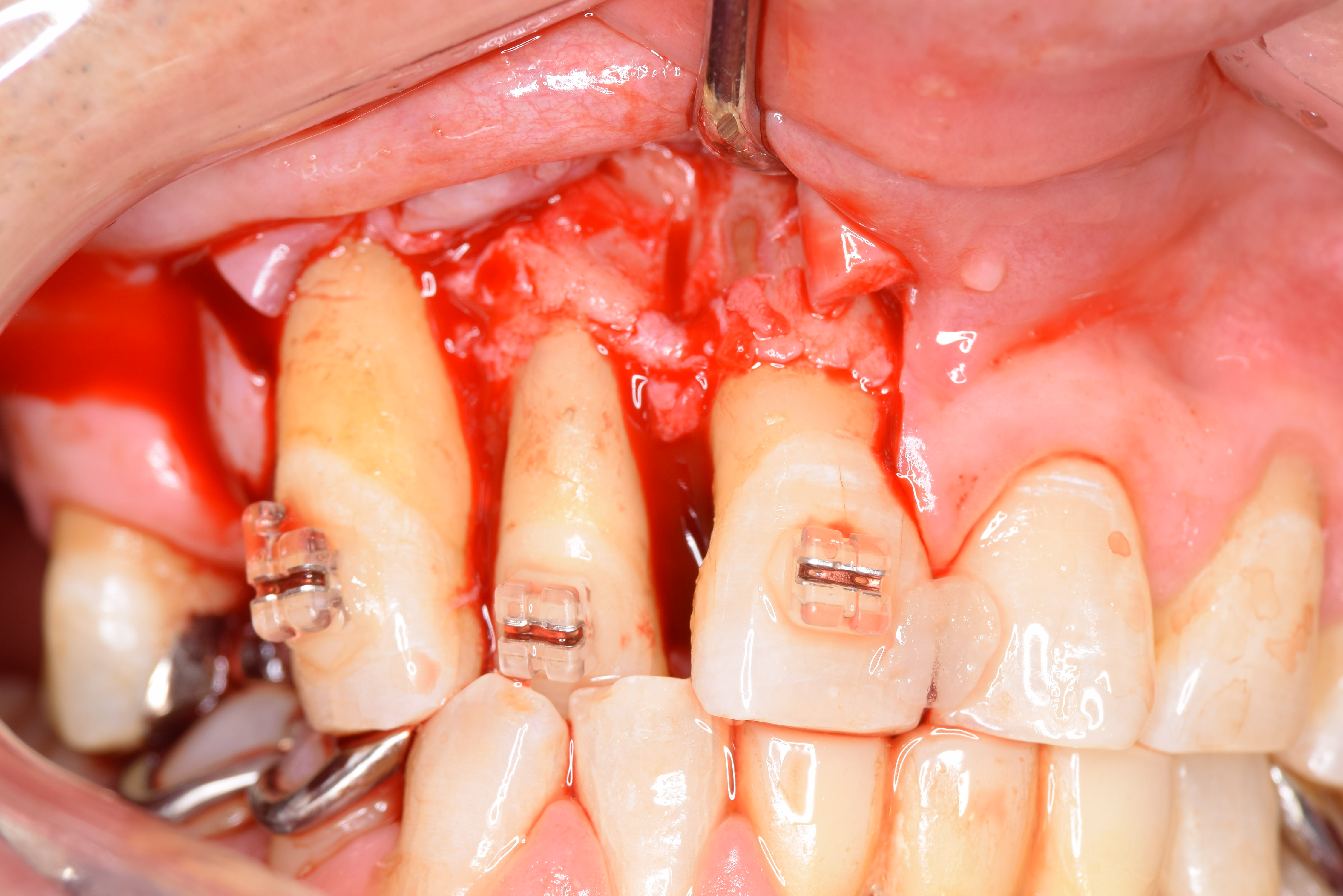 case3-2