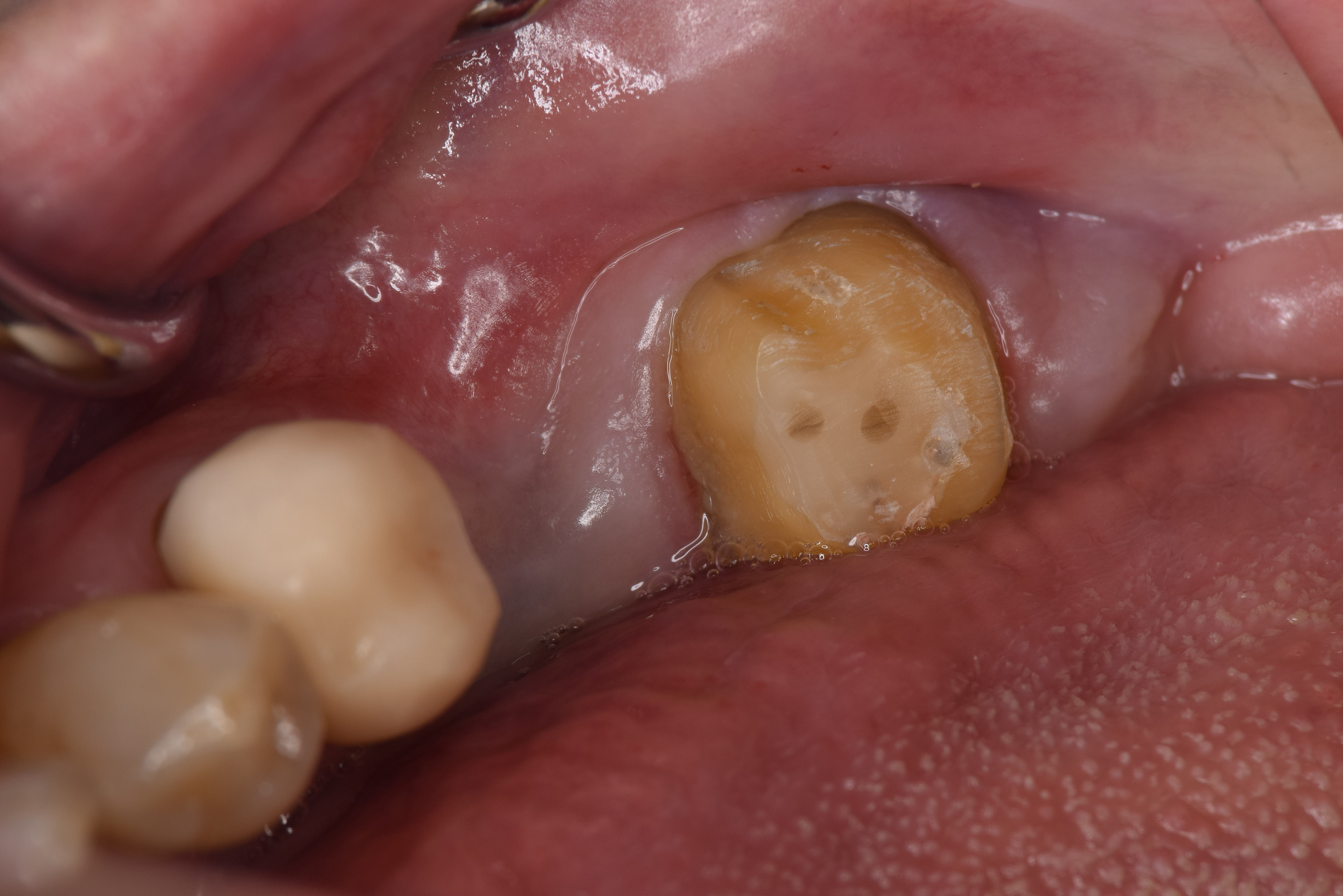 case4-1