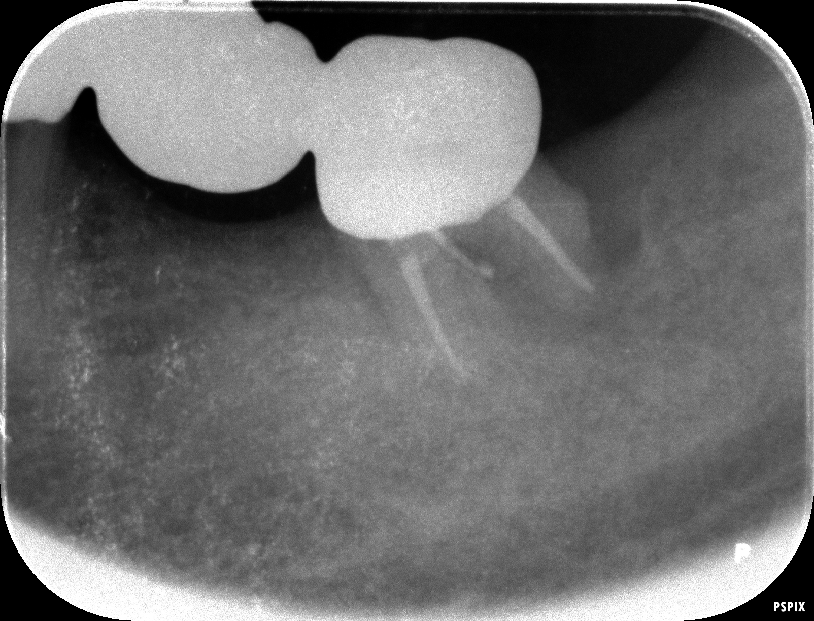 case4-3