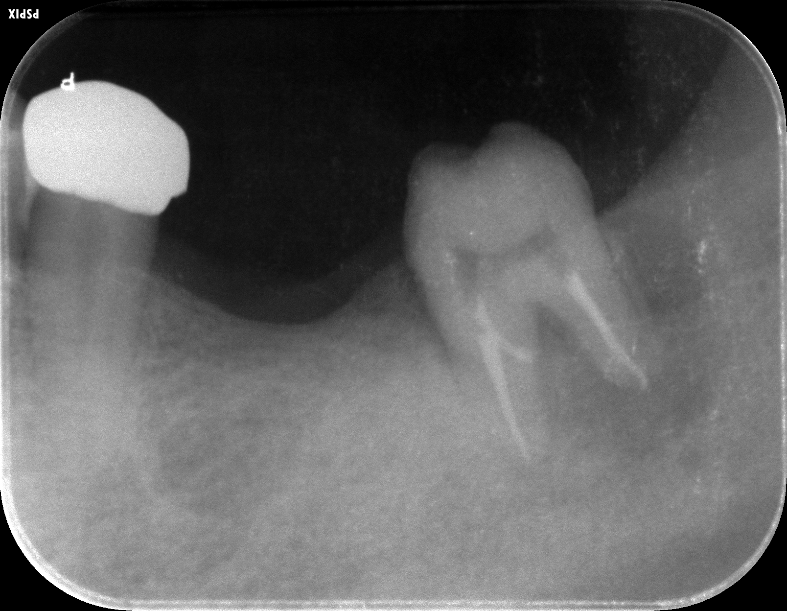 case4-7