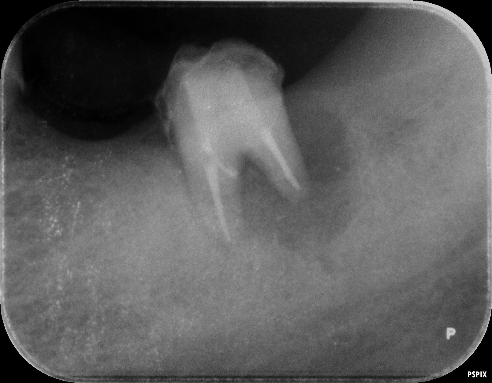 case4-2