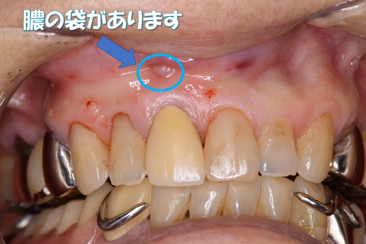 case5-1