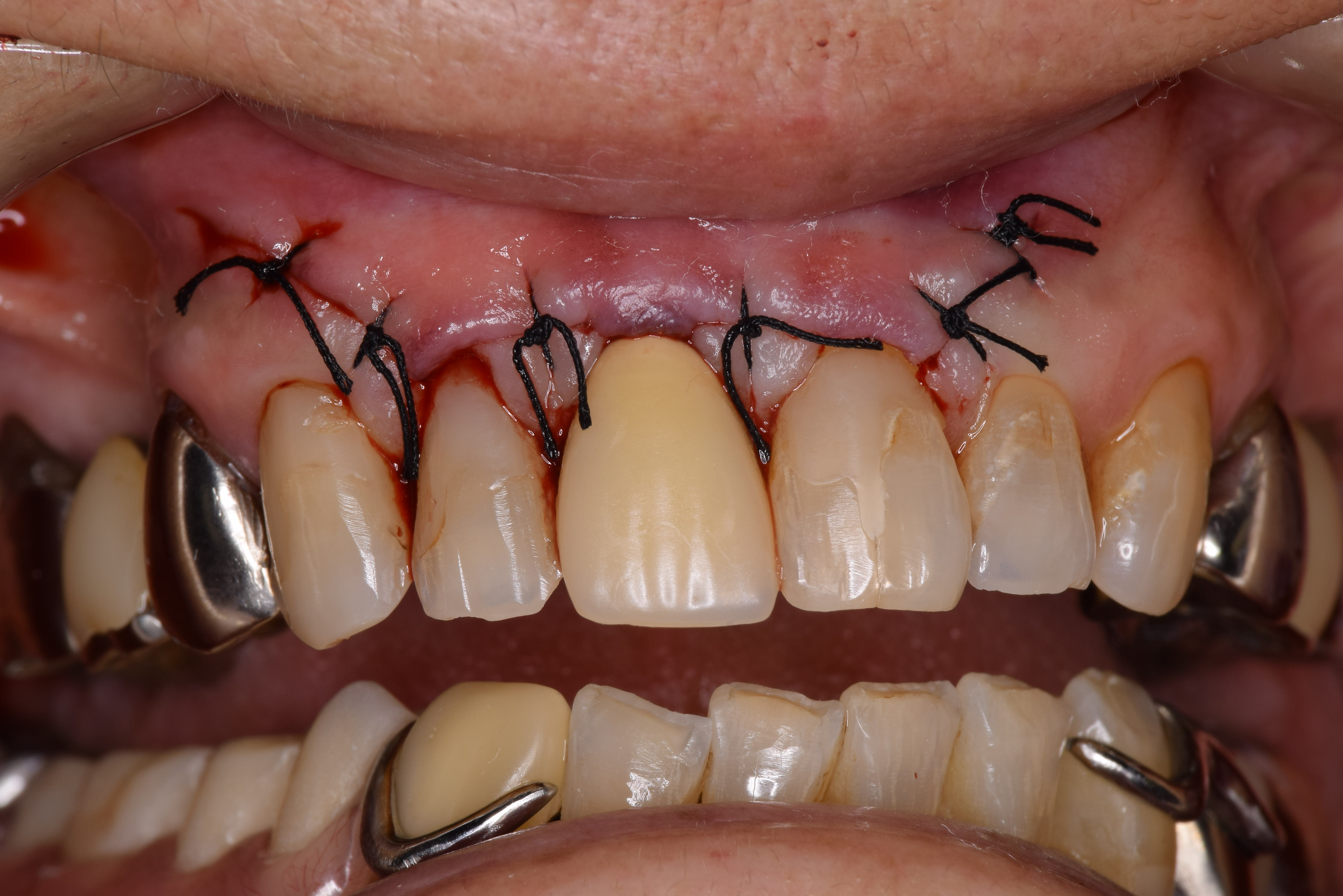 case5-2
