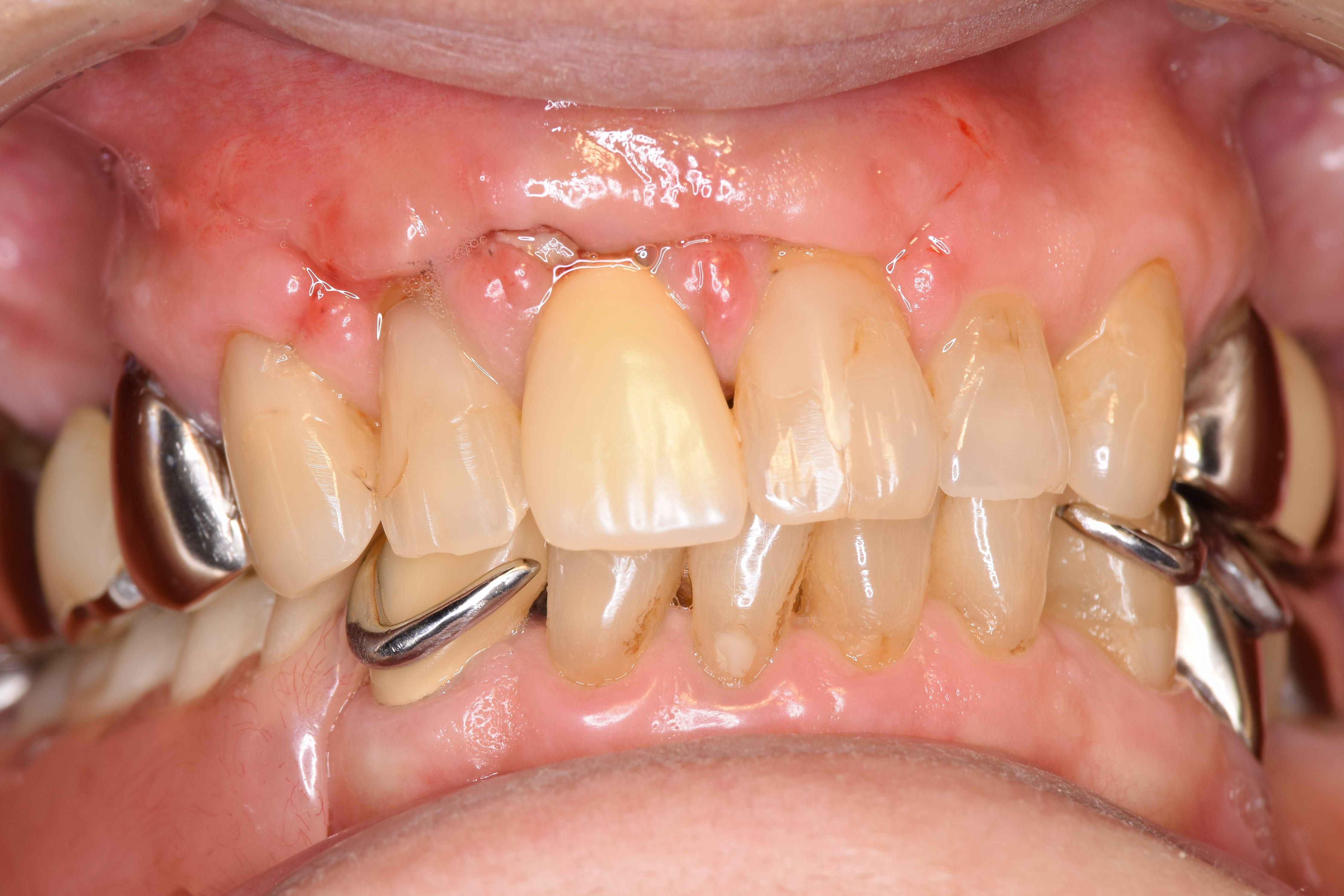 case5-3