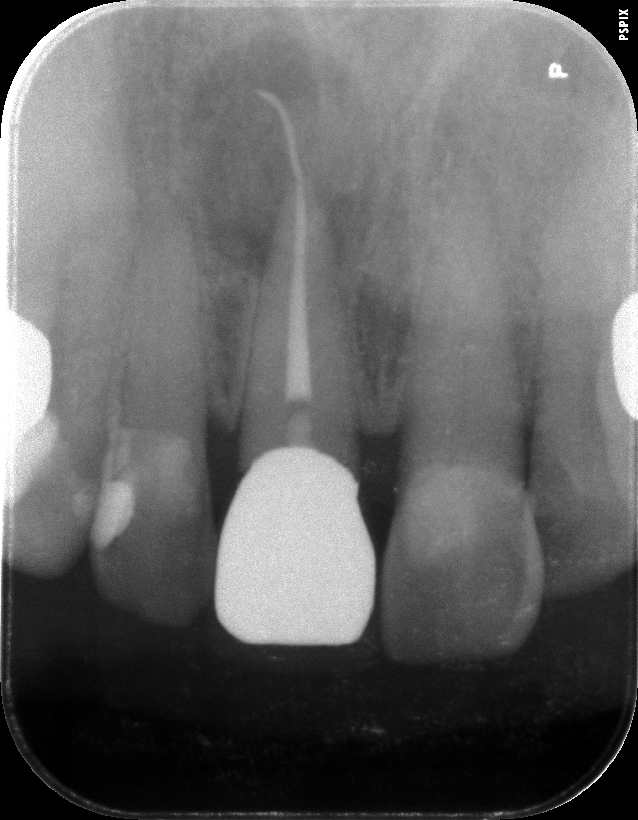 case4-7