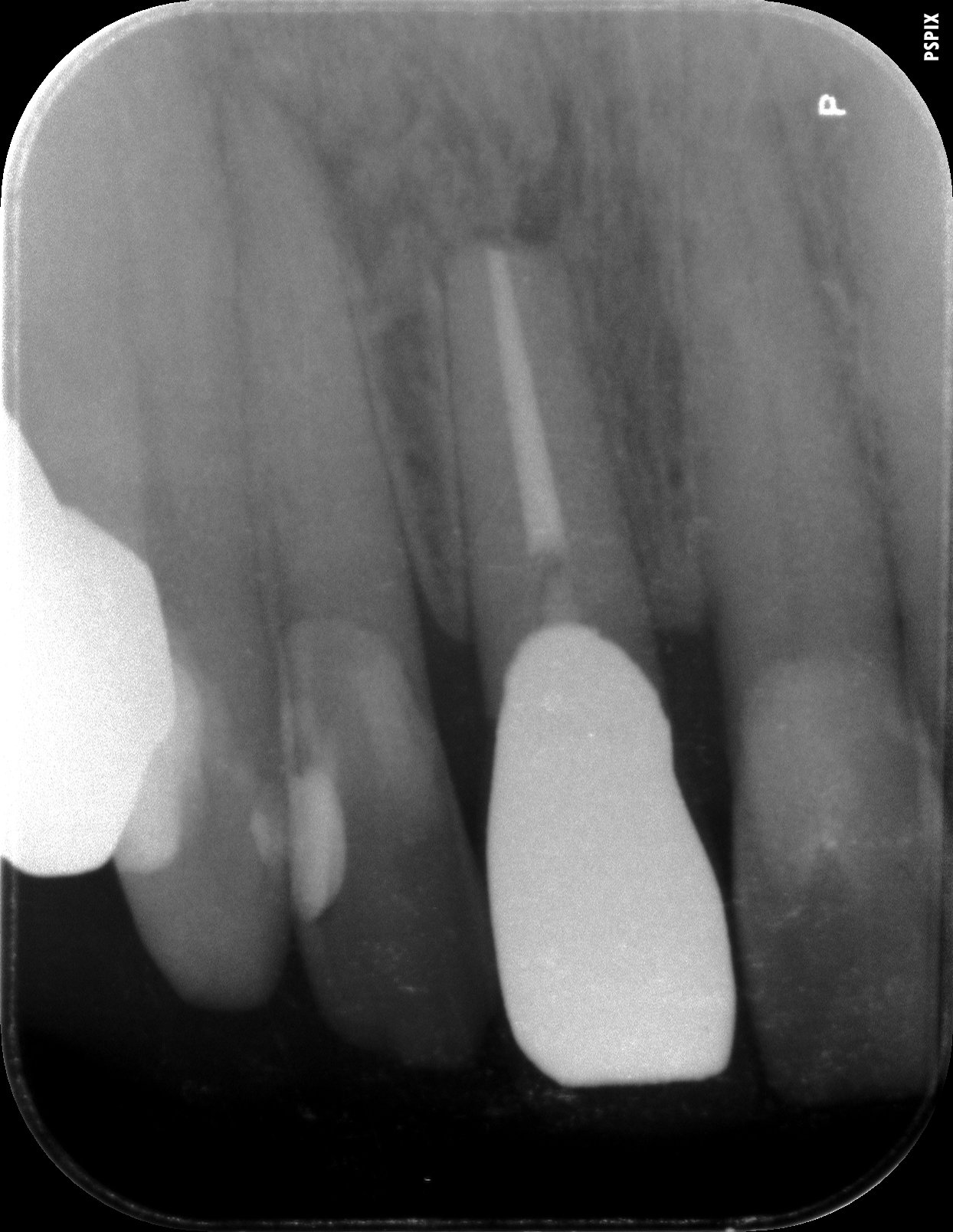 case5-5