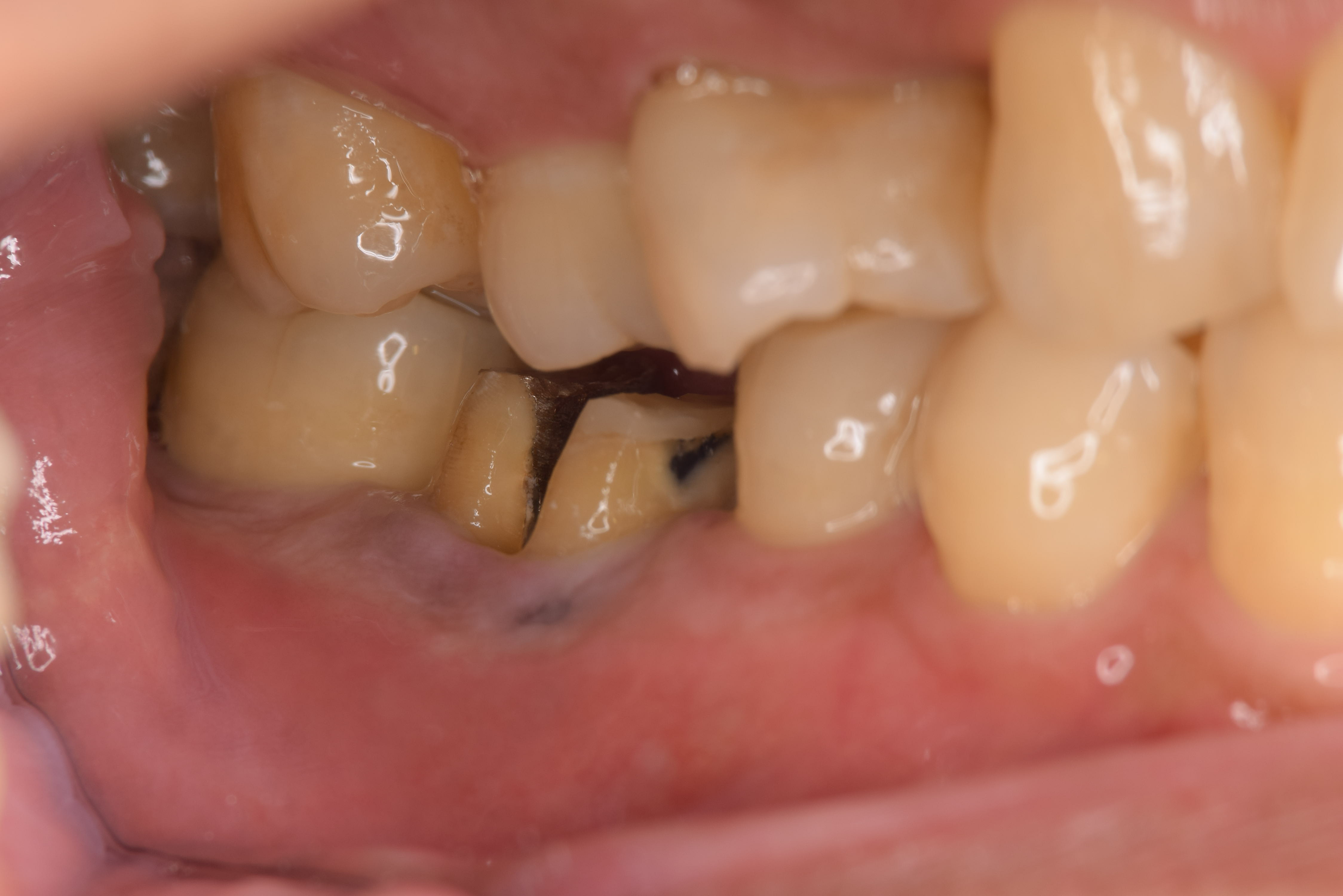case7-5
