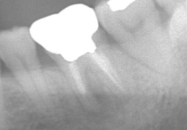 case7-6