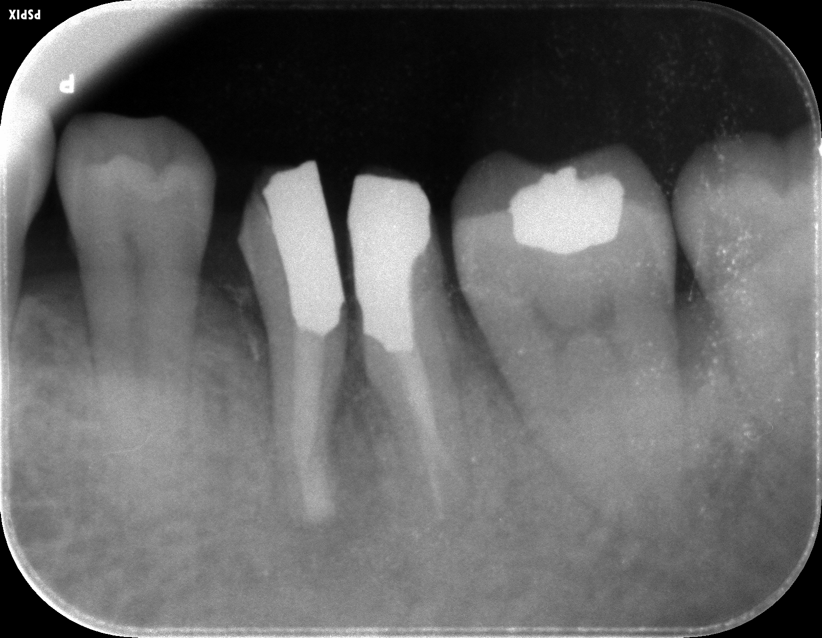 case7-7