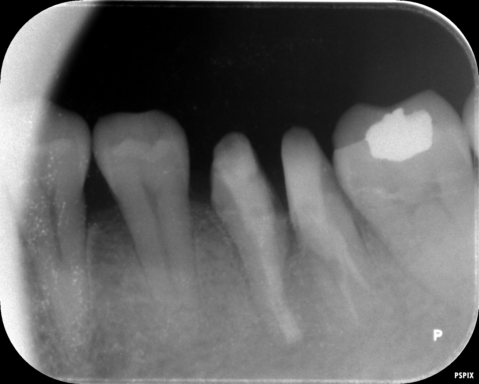case7-8