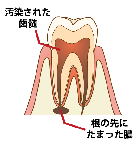 診断