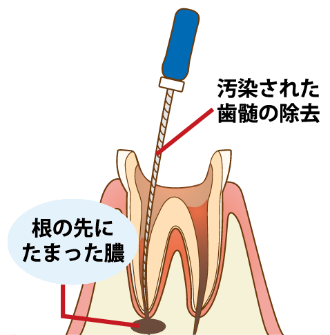 神経をキレイにする