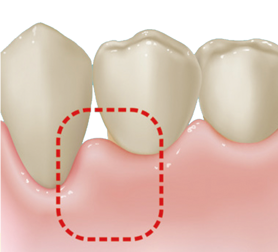 c1